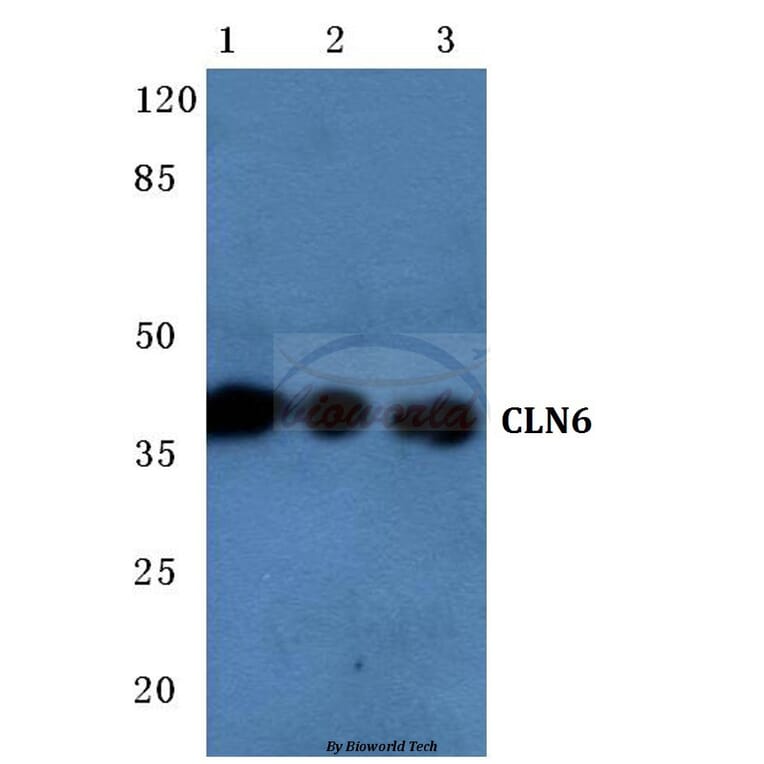 Anti-CLN6 (N258) Antibody from Bioworld Technology (BS3102) - Antibodies.com
