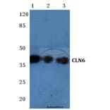 Anti-CLN6 (N258) Antibody from Bioworld Technology (BS3102) - Antibodies.com