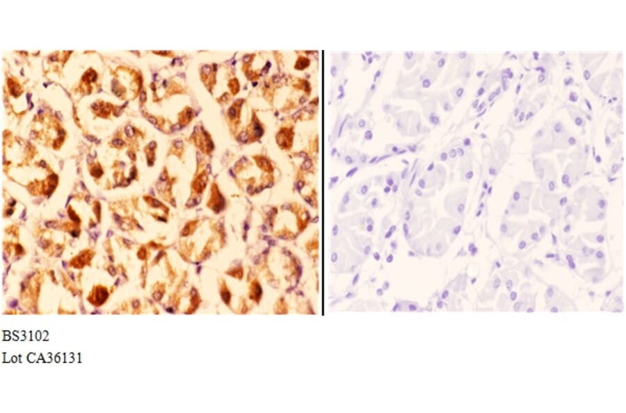 Anti-CLN6 (N258) Antibody from Bioworld Technology (BS3102) - Antibodies.com