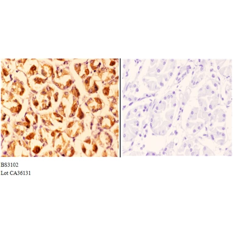 Anti-CLN6 (N258) Antibody from Bioworld Technology (BS3102) - Antibodies.com