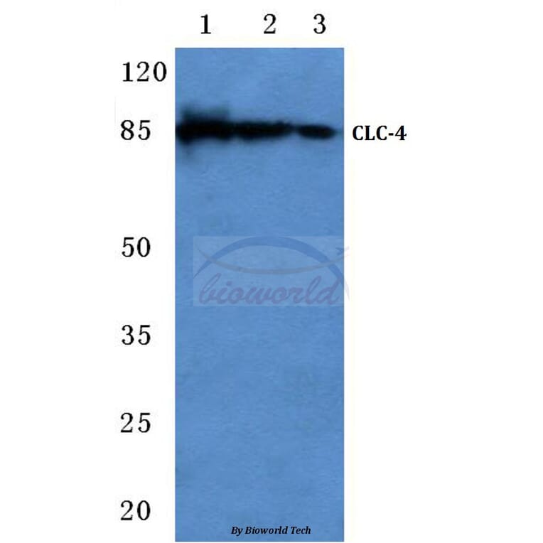 Anti-CLC-4 (E254) Antibody from Bioworld Technology (BS3103) - Antibodies.com