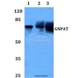 Anti-GNPAT (F365) Antibody from Bioworld Technology (BS3110) - Antibodies.com
