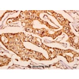 Anti-GNPAT (F365) Antibody from Bioworld Technology (BS3110) - Antibodies.com