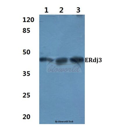 Anti-ERdj3 (K66) Antibody from Bioworld Technology (BS3114) - Antibodies.com