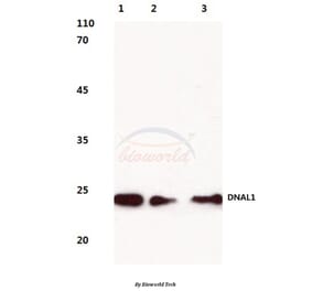 Anti-DNAL1 (N161) Antibody from Bioworld Technology (BS3115) - Antibodies.com