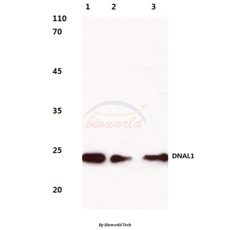 Anti-DNAL1 (N161) Antibody from Bioworld Technology (BS3115) - Antibodies.com