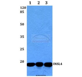 Anti-INSL4 (L79) Antibody from Bioworld Technology (BS3118) - Antibodies.com