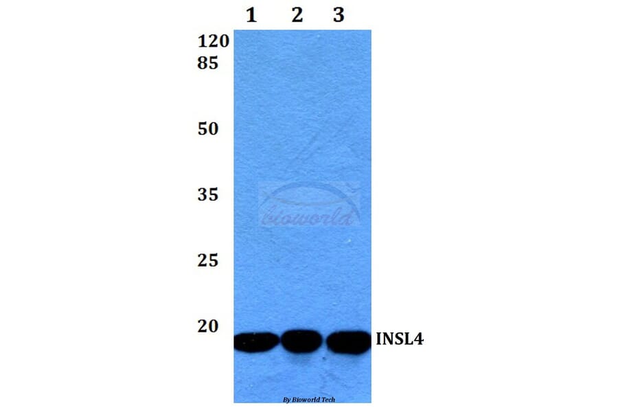 Anti-INSL4 (L79) Antibody from Bioworld Technology (BS3118) - Antibodies.com