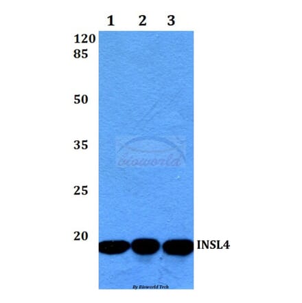 Anti-INSL4 (L79) Antibody from Bioworld Technology (BS3118) - Antibodies.com