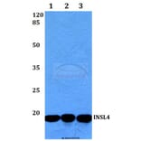 Anti-INSL4 (L79) Antibody from Bioworld Technology (BS3118) - Antibodies.com