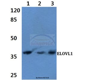 Anti-ELOVL1 (F139) Antibody from Bioworld Technology (BS3121) - Antibodies.com