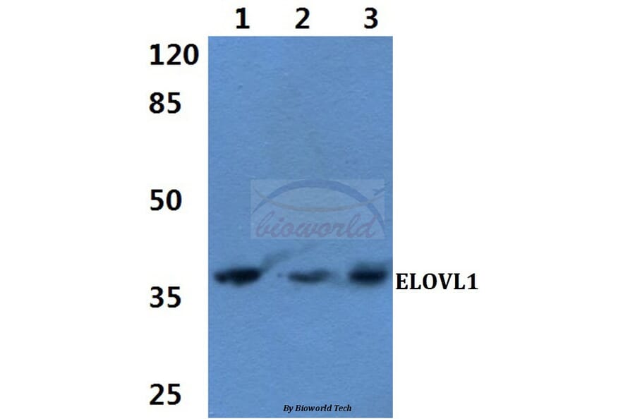 Anti-ELOVL1 (F139) Antibody from Bioworld Technology (BS3121) - Antibodies.com