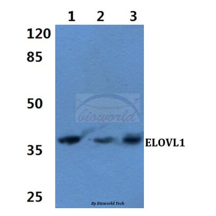 Anti-ELOVL1 (F139) Antibody from Bioworld Technology (BS3121) - Antibodies.com