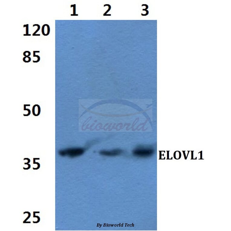 Anti-ELOVL1 (F139) Antibody from Bioworld Technology (BS3121) - Antibodies.com