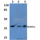 Anti-ELOVL1 (F139) Antibody from Bioworld Technology (BS3121) - Antibodies.com