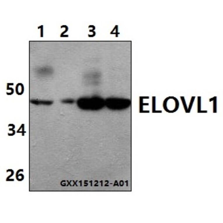 Anti-ELOVL1 (F139) Antibody from Bioworld Technology (BS3121) - Antibodies.com