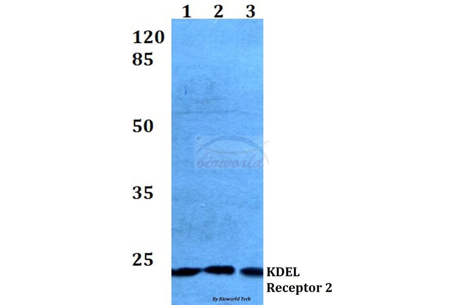 Anti-KDEL Receptor 2 (L119) Antibody from Bioworld Technology (BS3123) - Antibodies.com