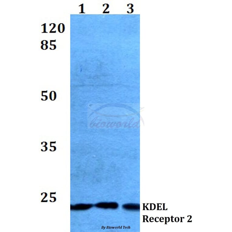 Anti-KDEL Receptor 2 (L119) Antibody from Bioworld Technology (BS3123) - Antibodies.com