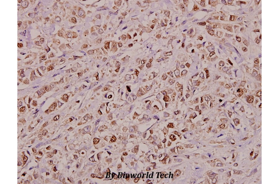Anti-KDEL Receptor 2 (L119) Antibody from Bioworld Technology (BS3123) - Antibodies.com