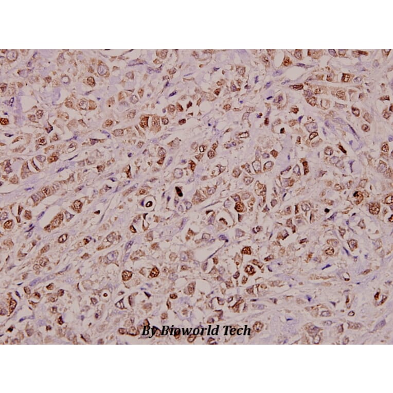 Anti-KDEL Receptor 2 (L119) Antibody from Bioworld Technology (BS3123) - Antibodies.com