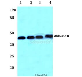 Anti-Aldolase B (W148) Antibody from Bioworld Technology (BS3127) - Antibodies.com
