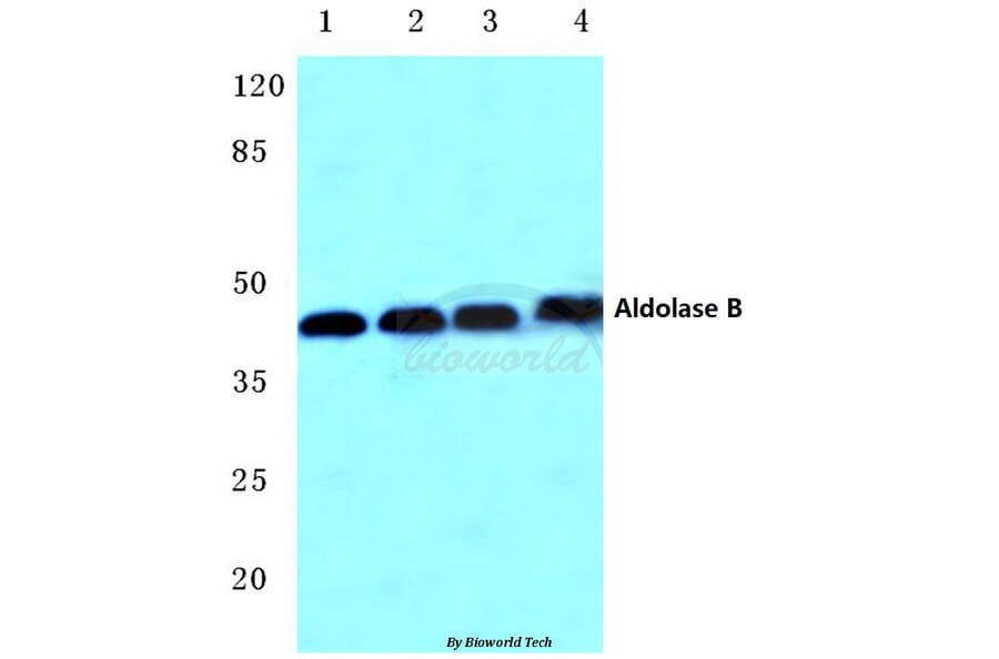 Anti-Aldolase B (W148) Antibody from Bioworld Technology (BS3127) - Antibodies.com