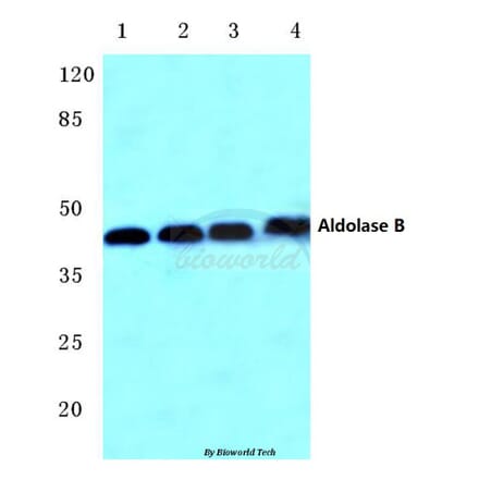Anti-Aldolase B (W148) Antibody from Bioworld Technology (BS3127) - Antibodies.com