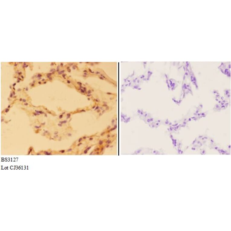 Anti-Aldolase B (W148) Antibody from Bioworld Technology (BS3127) - Antibodies.com