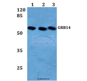 Anti-GRB14 (D123) Antibody from Bioworld Technology (BS3130) - Antibodies.com