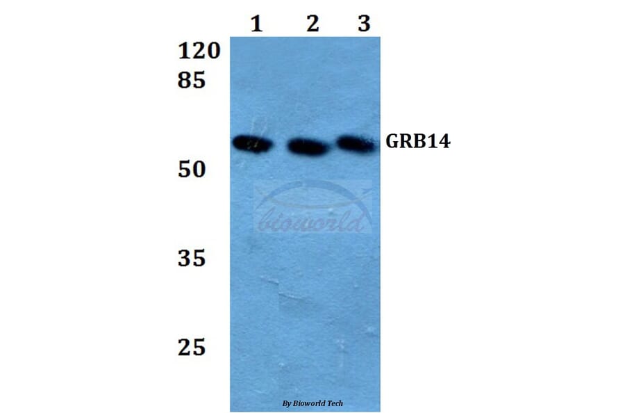 Anti-GRB14 (D123) Antibody from Bioworld Technology (BS3130) - Antibodies.com