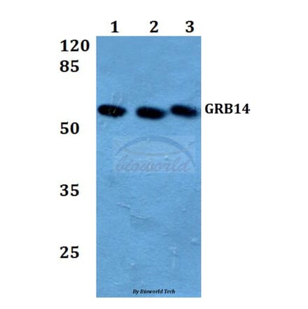 Anti-GRB14 (D123) Antibody from Bioworld Technology (BS3130) - Antibodies.com
