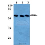 Anti-GRB14 (D123) Antibody from Bioworld Technology (BS3130) - Antibodies.com