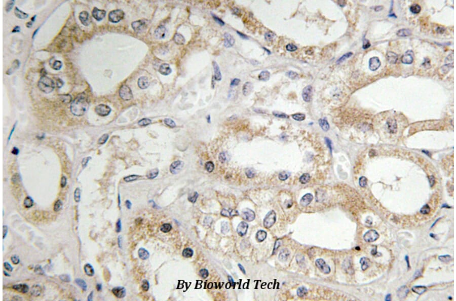 Anti-GRB14 (D123) Antibody from Bioworld Technology (BS3130) - Antibodies.com