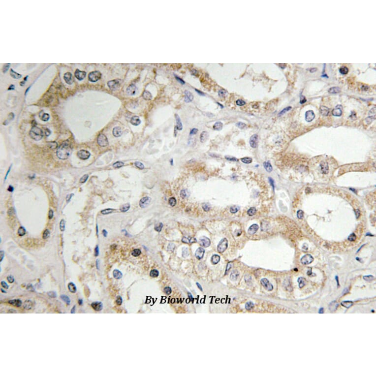 Anti-GRB14 (D123) Antibody from Bioworld Technology (BS3130) - Antibodies.com