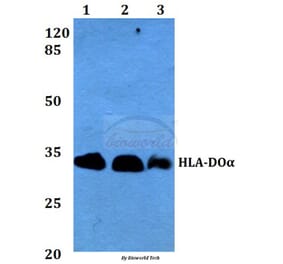 Anti-HLA-DOα (V111) Antibody from Bioworld Technology (BS3134) - Antibodies.com