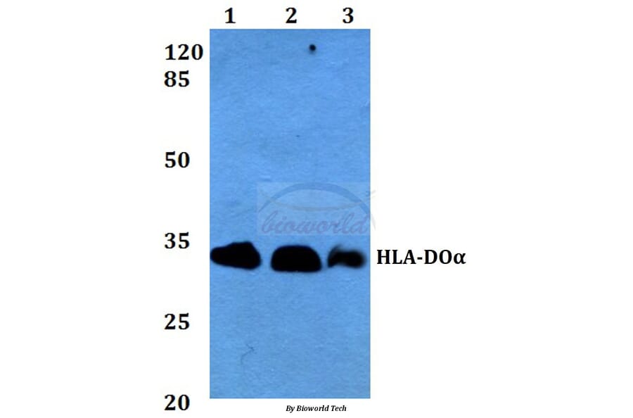 Anti-HLA-DOα (V111) Antibody from Bioworld Technology (BS3134) - Antibodies.com
