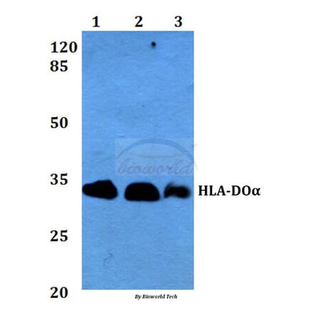 Anti-HLA-DOα (V111) Antibody from Bioworld Technology (BS3134) - Antibodies.com