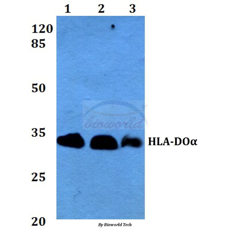 Anti-HLA-DOα (V111) Antibody from Bioworld Technology (BS3134) - Antibodies.com