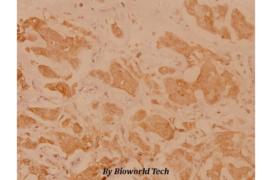 Anti-HLA-DOα (V111) Antibody from Bioworld Technology (BS3134) - Antibodies.com