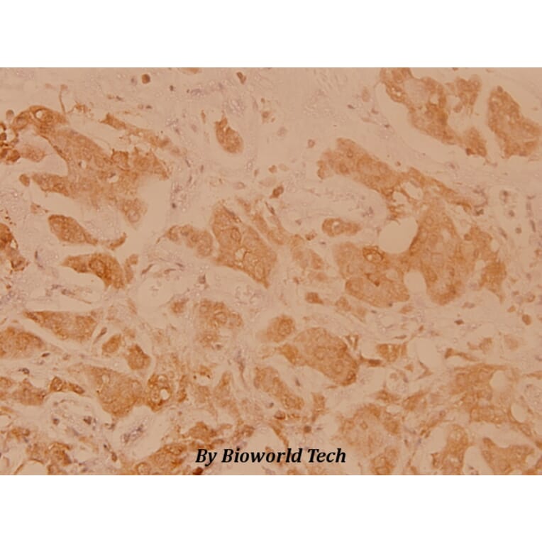 Anti-HLA-DOα (V111) Antibody from Bioworld Technology (BS3134) - Antibodies.com