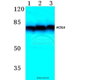 Anti-ACSL6 (D531) Antibody from Bioworld Technology (BS3140) - Antibodies.com