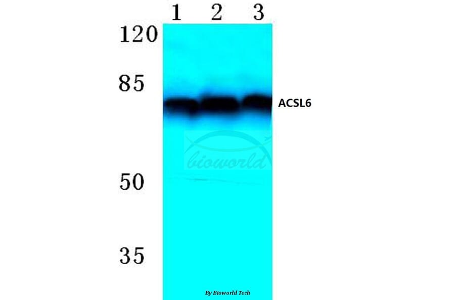 Anti-ACSL6 (D531) Antibody from Bioworld Technology (BS3140) - Antibodies.com