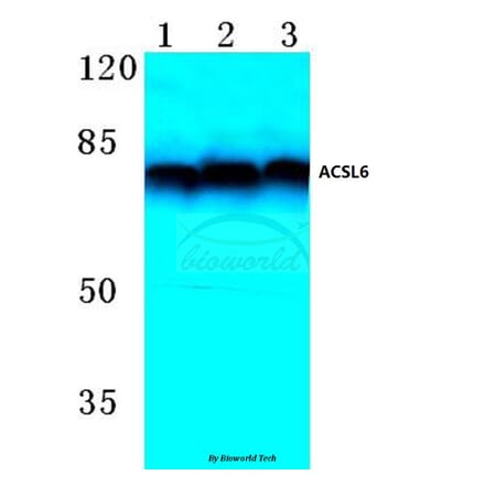 Anti-ACSL6 (D531) Antibody from Bioworld Technology (BS3140) - Antibodies.com