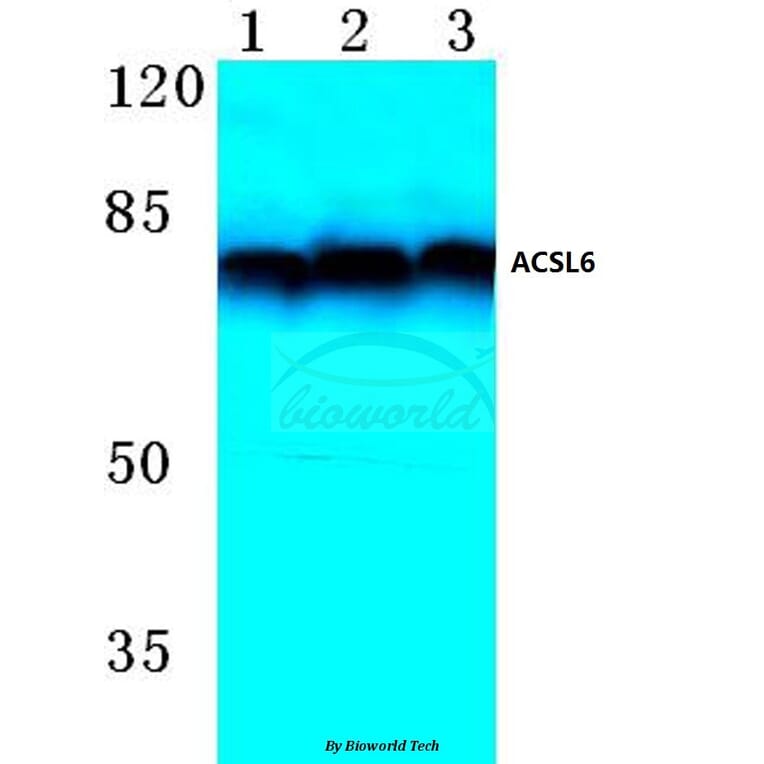 Anti-ACSL6 (D531) Antibody from Bioworld Technology (BS3140) - Antibodies.com