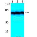 Anti-ACSL6 (D531) Antibody from Bioworld Technology (BS3140) - Antibodies.com