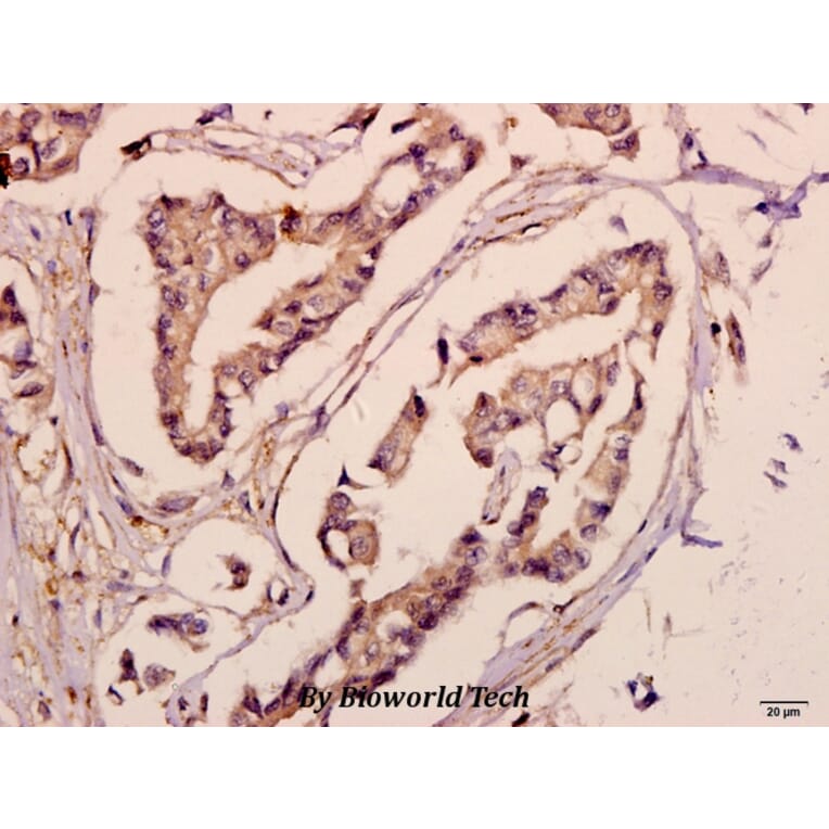 Anti-ACSL6 (D531) Antibody from Bioworld Technology (BS3140) - Antibodies.com