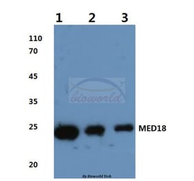 Anti-MED18 (V102) Antibody from Bioworld Technology (BS3141) - Antibodies.com