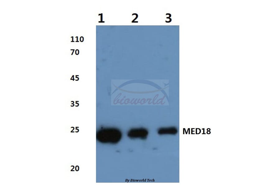Anti-MED18 (V102) Antibody from Bioworld Technology (BS3141) - Antibodies.com