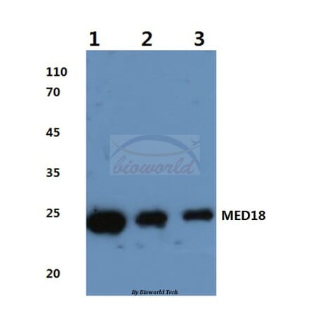 Anti-MED18 (V102) Antibody from Bioworld Technology (BS3141) - Antibodies.com