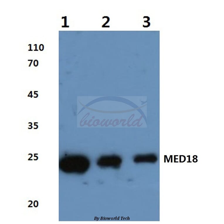 Anti-MED18 (V102) Antibody from Bioworld Technology (BS3141) - Antibodies.com